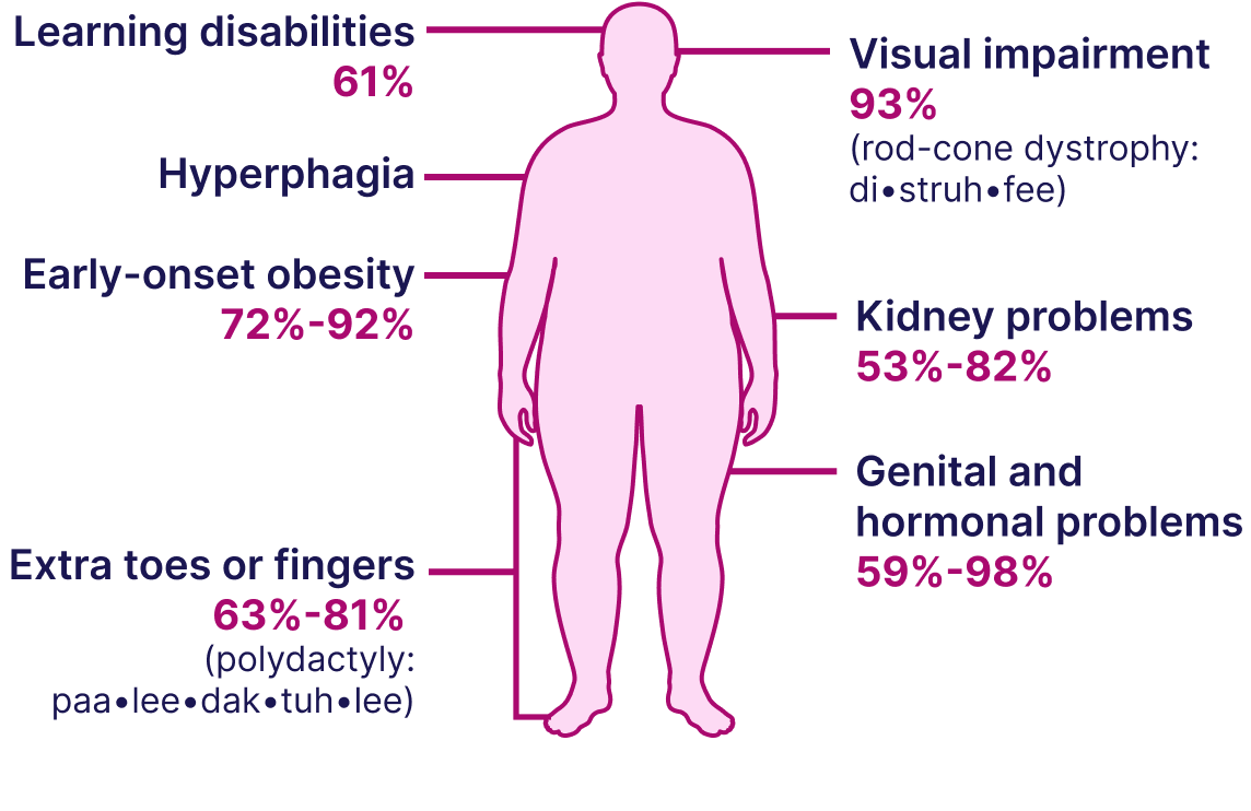Signs and symptoms of BBS diagram